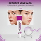 20 ml 12% azelainsyre aknekrem