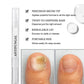 ✨NYHET 2026🔥 Antifungal penn for skadede tånegler | Kjøp 1 og få 1 gratis 🎉